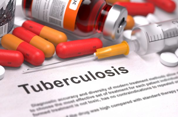 Diagnosis – Tuberculosis. Medical Concept.
