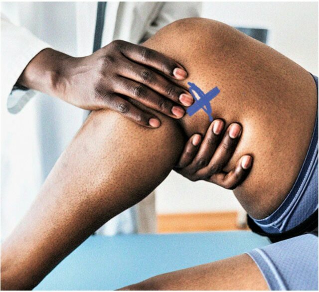 Why arthritis patients must consult therapists before exercise – Expert