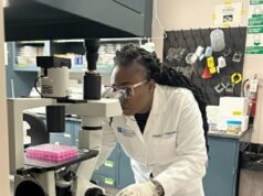 Scientist links immune system failure to liver damage in people with obesity Scientist links immune system failure to liver damage in people with obesity