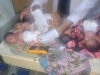 Kano Woman Dies After Giving Birth to Quintuplets as Newborns Survive Kano Woman Dies After Giving Birth to Quintuplets as Newborns Survive